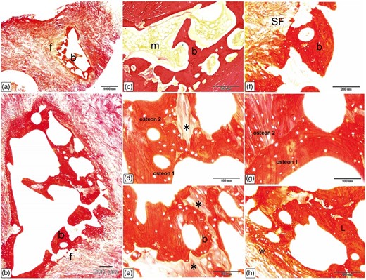 Histological characterization of Ossa cordis dextrum using Sirius Red stain. (a–c) The Ossa cordis dextrum consisted of trabecular bone tissue (b) with fibrous tissue (f) surrounding it and bone marrow (m). (d,e) The trabecular bone tissue showed lamellar bone with osteon structures. Note that the osteons labeled 1 and 2 consisted of bone lamellae and arranged in concentric circles surrounding an osteonic cavity. There were interstitial lamellae (asterisks) between osteons that are next to each other. (f) The top layer of the collagen fiber periosteum covered the Ossa cordis. Sharpey's fibers, which are made up of bundles of periosteal collagen fibers, connected the periosteum to the bone by going through the bone matrix. (g) Two osteons were adjacent to each other but not parallel to each other. (h) The outer layers of bone contained randomly arranged woven bone (w), while the inner layers had more mature, regularly arranged lamellar bone (L).