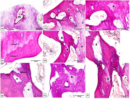 Histological characterization of Ossa cordis dextrum using Alcian blue Van Gieson. (a) The trabecular bone tissue (b) surrounding the marrow space (m) was clearly visible using the Alcian blue Van Gieson stain. b–h: The trabecular bone (b) had venous spaces that connected to each other, and osteoblasts were present around these spaces with osteon structures present. There were interstitial lamellae (asterisks) between osteons that were next to each other, and notably the interstitial lamellae were associated to bone material that was high in carbohydrates (intense staining). The interstitial lamellae were connected to the bone matrix, which was high in carbohydrates (arrows). The collagen fibers in woven bone (w) were arranged in a random way. The periosteum (p) covered the Ossa cordis, and the trabecular bone surface was covered with osteoblasts (double arrowheads) and osteocytes (arrowheads) were visualized within lacunae. In cases (c) and (d), the osteons within the Ossa cordis bone tissues were oriented in different directions to each other, and the collagen lamellae were not parallel to the collagen lamellae of the neighboring osteon.