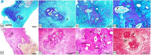 Histological characterization of Ossa cordis sinistrum using Crossman's trichrome (a–d), Alcian blue Van Gieson (e–g), and Sirius Red (h). (a,b,e) The Ossa cordis sinistrum (where present) were located in the initial portion of the ascending aorta. They consisted of trabecular bone covered externally by a periosteum and were surrounded by fibrous tissue. (c,d,f,g) The Ossa cordis sinistrum trabecular bone had typical morphology osteons (o) with concentric organization of bone lamellae surrounding vascular channels (v). The peripheral parts of the bone tissue consisted of woven bone (w), which was distinguished from the lamellar bone due to the disorganized structure of the fibrous components. (h) Sharpey's perforating fibers (fibers) extended form the periosteal collagen fibers and linked the periosteum and the bone.