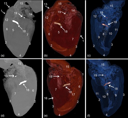 CT 3D rendered volume of the cattle heart showing the Ossa cordis dextrum and sinistrum. (a–c) Left view and (d–f) right view. (a,d) Ghost (black and white), (b,e) color render, and (c,f) blue angiography without contrast media. 1. Pericardium cavity, 2. Cranial border, 3. Caudal border, 4. Apex, 5. Left longitudinal interventricular groove (sulcus interventricularis paraconlais), 6. Right ventricle, 7. Left ventricle, 8. Interventricular septum, 9. Right ventricular cavity, 10. Left ventricular cavity, 11. Ventricular wall, 12. Conus arteriosus, 13. Right auricle, 14. Left auricle, 15. Aorta, 16. Right longitudinal interventricular (sulcus interventricularis subsinuosus), 17. Intermediate longitudinal groove, 18. Ossa cordis dextrum, and 19. Ossa cordis sinistrum.