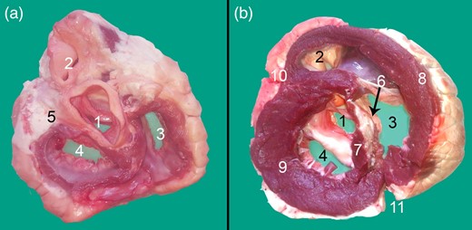 Transverse cross section at the base of the heart displaying the Ossa cordis dextrum. (a) Dorsal view and (b) Ventral view. 1. Aortic orifice (valve), 2. Pulmonary trunk valve, 3. Right atrioventricular orifice, 4. Left atrioventricular opening, 5. Left trigone, 6. Ossa cordis dextrum, 7. Interventricular septum, 8. Right ventricular wall, 9. Left ventricular wall, 10. Left longitudinal interventricular groove (sulcus interventricularis paraconlais), and 11. Right longitudinal interventricular (sulcus interventricularis subsinuosus).