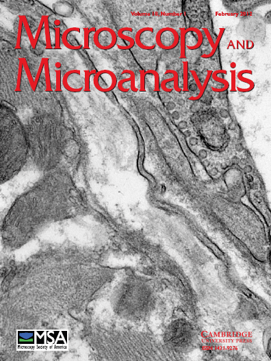 Microanalyses Phase Contrast Synchrotron Microtomography: Improving Noninvasive ...