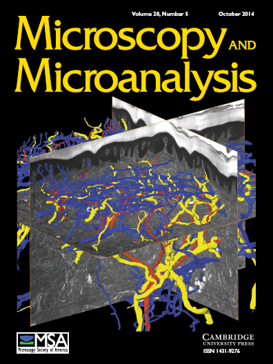 Electron Microscopy: Methods and Protocols (3rd Ed.). Kuo John (Ed ...
