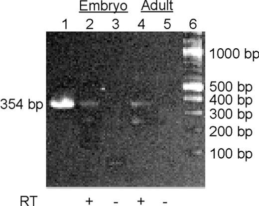 RT-PCR reactions using adra2db-specific primers run on a 1.5% agarose gel. Lane 1: a 354-bp adra2db fragment amplified from genomic DNA. Lanes 2 and 4: the same 354-bp adra2db amplification product from RT-PCR using RNA isolated from 48 to 50 hpf embryos (lane 2) or adult zebrafish (lane 4) as templates. There are some smaller bands visible in both lanes, probably presenting prematurely terminated products. Lanes 3 and 5: same as above, but without RT to show that no genomic DNA contamination exists. The less than 100-bp band in lane 3 probably represents remnants of the template and primers. Lane 6: DNA size marker