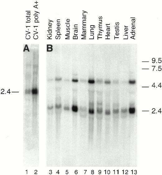 Tissue Distribution of NUDR mRNA Expression in CV-1 Cells and Rat Tissues A, Ten micrograms of total RNA (lane 1) and poly A+ RNA (lane 2) from CV-1 cells were electrophoresed in a 1% denaturing agarose gel, transferred to a nylon membrane, and hybridized with radiolabeled sNUDR probe. B, Ten micrograms of poly A+ RNA from various rat tissues (lanes 3–13) were subjected to Northern blot analysis as in panel A except the blot was hybridized with a radiolabeled rat cDNA probe. The blots were exposed to film and the film was scanned with a densitometer. The mobility of NUDR is shown on the left and the RNA size standards (in kilobases) are shown on the right.