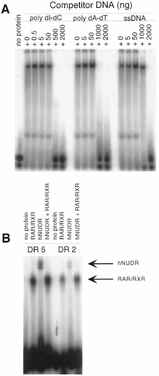 Electrophoretic Mobility Shift Assay A, A 32P-labeled DR5 RARE oligo (120 fmol) was incubated with 35 pmol of recombinant hNUDR protein with increasing quantities (0–2000 ng) of nonspecific competitor DNA: either poly dI-dC, poly dA-dT, or salmon sperm DNA (ssDNA). B, Either 32P-labeled DR5 RARE or DR2 RARE oligos (240 fmol) were incubated with 38 pmol of recombinant hNUDR protein and/or 1 pmol of recombinant hRARα and in vitro translated hRXRα. Protein-DNA complexes were separated from free probe on a 4% nondenaturing gel. Results were imaged with a PhosphorImager. In panel B, the arrows indicate hNUDR-shifted RARE complex and RAR/RXR-shifted RARE complex.