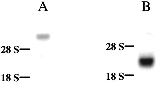Northern Blot Demonstrating the Specificity of the Probes for FLT-1 (A), or sFLT-1 (B) Transcripts