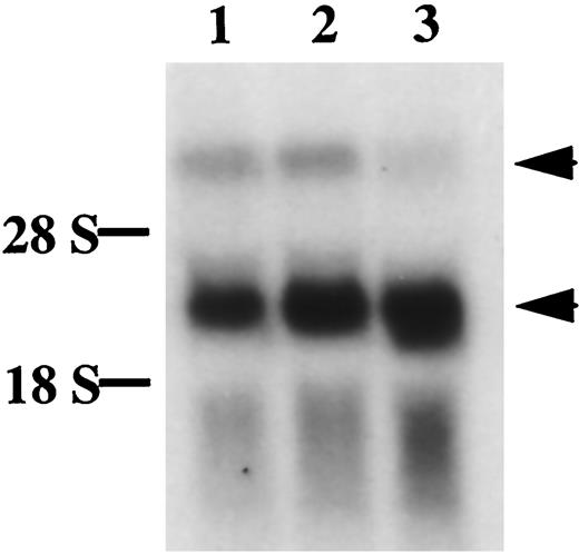 Northern Blot Analysis of Total RNAs from Placenta of Days 13 (lane 1), 15 (lane 2), and 17 (lane 3) Using a cDNA Probe for Detecting Both FLT-1 and sFLT-1 Transcripts Upper arrowhead, FLT-1 transcripts; lower arrowhead, sFLT-1 transcripts.
