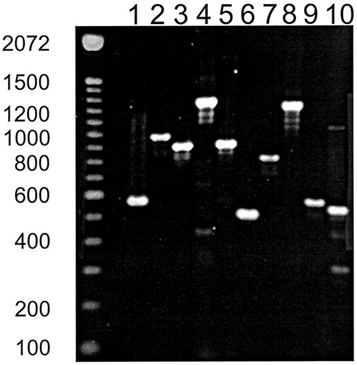 覆盖VLGR1 cDNA全长的RT-PCR标记如图1所示。尺寸标准为碱基对。RT-minus对照反应无扩增（未显示）。