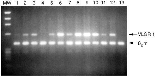 用RT-PCR和琼脂糖凝胶溴化染色观察VLGR1在正常人体组织中的表达分布。每条通道中的上带（570-bp PCR产物）代表VLGR1的表达，而下带（400-bp产物）代表β2-微球蛋白mRNA。1，卵巢；2、小肠；胃粘膜；4、肝脏；5、肾上腺；6、睾丸；7、结肠；8、肺；9、甲状腺；10、骨骼肌；包皮成纤维细胞；12、肾脏；13、脾脏。