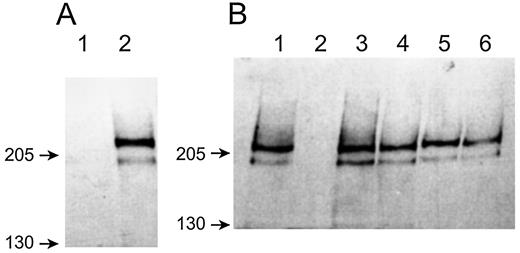 VLGR1 A的细胞表面表达，人类胚胎肾293细胞洗涤剂裂解物的Western blot，转染有编码绿色荧光蛋白的对照质粒（通道1）或编码HA标记VLGR1的质粒（通道2）。显示了以千吨为单位的尺寸标准。B、 细胞表面标记实验。通道1，用编码HA-tagged VLGR1的质粒转染293个细胞的裂解液（与通道A2不同的转染）；通道2，与该细胞裂解物孵育的链霉亲和素珠结合的物质；通道3，去除珠子后的裂解液上清液；车道4，裂解前用磺基琥珀酰亚胺-6-（生物胺基）己酸盐孵育的相同转染细胞的裂解液；通道5，与该细胞裂解物孵育的链霉亲和素珠结合的物质；通道6，去除珠子后的裂解液上清液。通道1、3、4和6包含等量的裂解液，通道2和5包含等量来自珠的洗脱液。