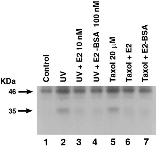 Procaspase-9 Is Cleaved by UV (1-Min Exposure) or Taxol (20 μm), Which Is Prevented by E2 or E2-BSA MCF-7 cells were exposed to UV or taxol in the presence or absence of E2 or E2-BSA, as described, then incubated for a total of 4 h. Cell lysates were then immunoprecipitated for caspase-9, using a monoclonal antibody that recognizes unprocessed and processed forms of the caspase-9 zymogen. After SDS-PAGE separation and membrane transfer, Western blot for caspase-9 was carried out. A representative study is shown, repeated three times.