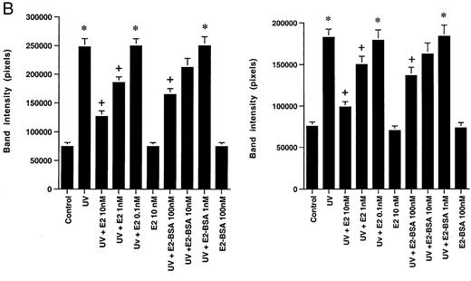 A, The c-Jun Kinase Activity in MCF-7 Cells (upper) and ZR-75–1 Cells (lower) after 15-Min Exposure to UV (left) or Taxol (right), in the Presence or Absence of E2, E2-BSA, or ICI182,780 JNK was immunoprecipitated from the treated MCF-7 cells, as described in Materials andMethods. A representative experiment of JNK activity directed against GST-c-Jun-(1–79) as substrate protein is shown, with the Jnk-1 immunoblots below each condition. The bargraph represents mean results ± SE of three experiments combined. *, P < 0.05 for control vs. UV or taxol; +, P < 0.05 for UV or taxol vs. UV or taxol plus E2 or E2-BSA; ++, P < 0.05 for UV or taxol plus E2 or E2-BSA vs. the former plus ICI. B, Concentration-related inhibition of UV- or taxol-stimulated JNK activity by E2 or E2-BSA in MCF-7 (left) and ZR-75–1 (right). The data reflect three separate experiments combined.