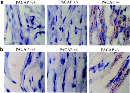 Heart Tissue and Skeletal Muscle Stained with Oil Red O a, Microvesicular fat in the PACAP−/− heart cells. b, Microvesicular fat in PACAP−/− skeletal muscle cells. Fat was not observed in PACAP+/+ or PACAP+/− heart or muscle cells.