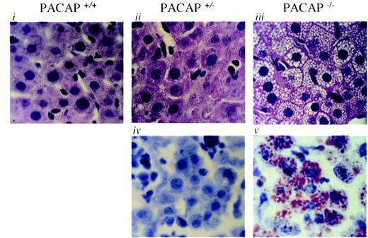 Morphology of Hepatocytes from PACAP+/+, PACAP+/−, and PACAP−/− Mice Microvesicular fat in the hepatocytes of PACAP−/− mice (iii), but not in the PACAP+/+ and PACAP+/− hepatocytes (i and ii). Fat is shown in PACAP−/− hepatocytes by Oil Red O staining of frozen sections (v), but is not shown in PACAP+/− mice (iv).