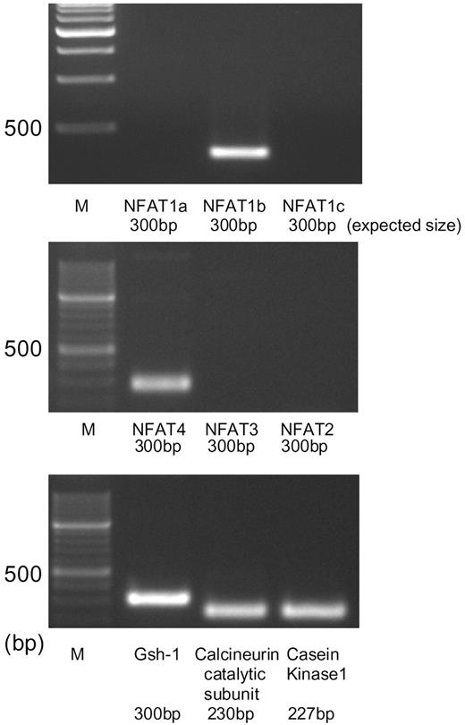 RT-PCR Analysis of the Expression of NFAT and Related Gene Transcripts in Gsh+/+ Cells Total RNA was extracted from the Gsh+/+ cells, and 1 μg was applied for RT reaction, followed by PCR using specific primer sets for each mRNA. The figure shows photographs of the ethidium bromide-stained products using agarose gel electrophoresis. Bands corresponding to NFAT1b, NFAT4, catalytic subunits of calcineurin, casein kinase 1, and Gsh-1 mRNAs were amplified. NFAT1a, NFAT1b, and NFAT1c are splice variants derived from a single gene.