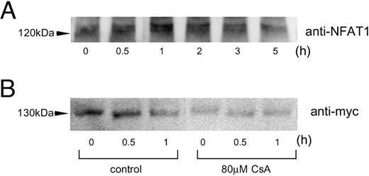 Depolarization-Induced Nuclear Translocation of NFAT1 A, Gsh+/+ cells were treated with 80 mm KCl for the time intervals indicated. Western blot analysis of the nuclear protein was then carried out using anti-NFAT1 antibody. B, Gsh+/+ cells, transfected with 1 μg of human NFAT1c/pcDNA3.1/myc/His, were pretreated with/without cyclosporin A (CsA; 80 μm). The cells were then depolarized with KCl (80 mm) for the defined time intervals, and nuclear protein extracted was applied for Western blot analysis.