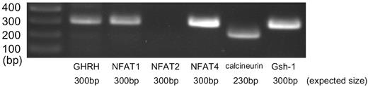 Expression of NFAT Families in the Arcuate Nucleus of the Rat Hypothalamus Rat brain was coronal-sectioned at the position 4.2-mm caudal from bregma, and arcuate nuclei were punched out by an 18-gauge fine needle. One microgram of total RNA extracted from the sample was reverse-transcribed and then analyzed by RT-PCR using specific primers. The figure shows photographs of the ethidium bromide-stained products using agarose gel electrophoresis.