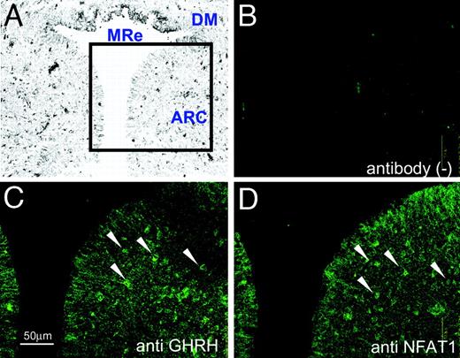 Colocalization of NFAT1 and GHRH in the Arcuate Nucleus of the Hypothalamus Analyzed by Immunofluorescence Photomicrographs A–D, Rat brain was coronal-sectioned at the position 4.2-mm caudal from bregma, and the arcuate nucleus was stained with anti-GHRH antibody (C), anti-NFAT1 antibody (D), or without antibody (B). Sections B–D are serial in order and 8 μm in thickness. The arrows indicate both the GHRH- and NFAT1-positive neurons. A weakly magnified gray-scale image (A) is referenced to show the location. MRe, Mammillary recess third ventricle; DM, dorsomedial hypothalamic nucleus; ARC, arcuate nucleus. Scale bar, 50 μm.