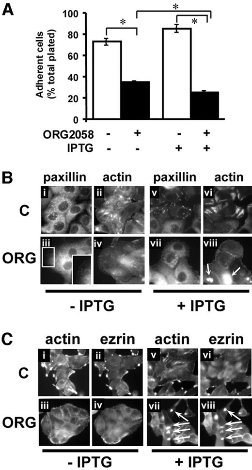 Progestin Regulation of Cell Shape and Adhesion T-47DN5 cells were treated for 24 h with 10 mm isopropyl-β-d-thiogalactopyranoside (IPTG) or vehicle and then for 48 h with 10 nm ORG2058 or vehicle. A, Cells were harvested, counted, and allowed to readhere for 2 h, before reharvesting and counting. Cells that readhered are expressed as a percentage of total replated in each sample. Open bars, Control; solid bars, 48 h ORG2058. Each data point is the mean of three replicates. Error bars represent mean se for the three replicates. B, Control (i, ii, v, vi) and ORG (iii, iv, vii, viii)-treated cells were fixed and stained as described in Materials and Methods, to visualize paxillin (i, iii, v, vii) and polymerized actin (ii, iv, vi, viii). C, Control (i, ii, v, vi) and ORG (iii, iv, vii, viii)-treated cells were fixed and stained as described in Materials and Methods, to visualize polymerized actin (i, iii, v, vii) and ezrin (ii, iv, vi, viii). C, Control; ORG, ORG2058.