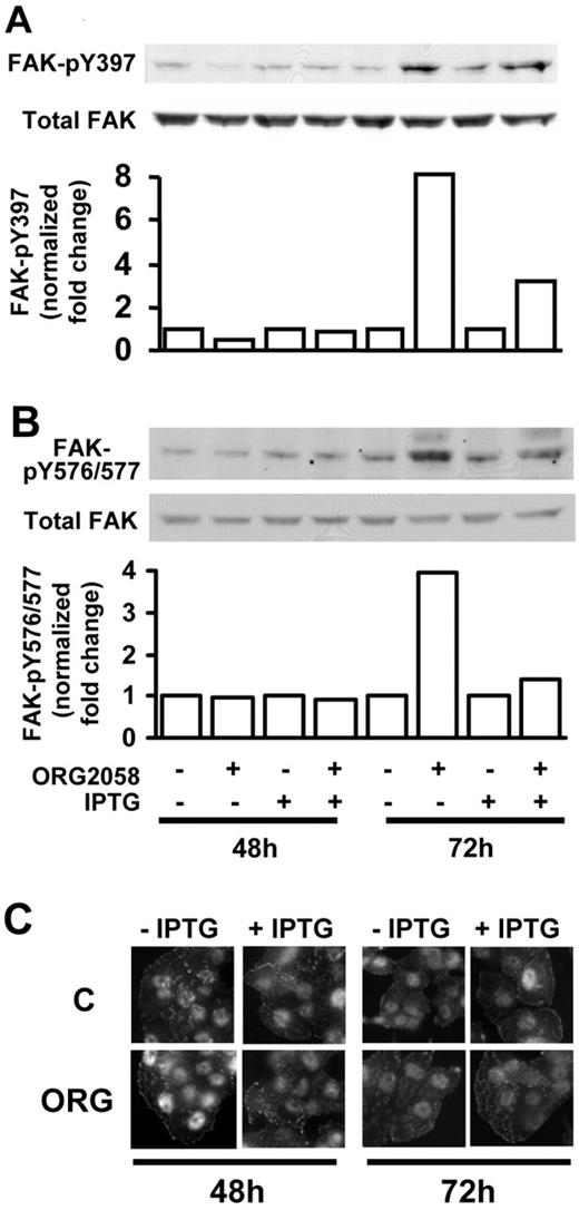 Progestin Regulation of FAK Activity T-47DN5 cells were treated for 24 h with 10 mm isopropyl-β-d-thiogalactopyranoside (IPTG) or vehicle, to induce PRA, and then for 48 or 72 h with ORG2058 or vehicle, as indicated. Whole-cell lysates were fractionated on a 7.5% acrylamide denaturing gel, and total and activated (pY397 and pY576/577) FAK were detected by immunoblotting. Relative expression of total and phosphorylated FAK bands was estimated by densitometry, and activated FAK levels are graphed relative to controls, normalized to total FAK. A, Activation of FAK on autophosphorylation site pY397. B, Levels of Src-dependent activation on pY576/577. C, Cells grown on coverslips, and treated as described above, were fixed and stained for FAK-pY397. C, Control; ORG, ORG2058