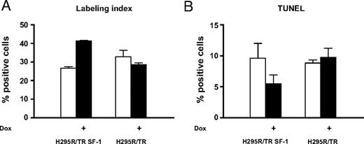 An Increase in SF-1 Dosage Augments S-Phase and Reduces Apoptosis in Human Adrenocortical Cells Percentage of BrdU-positive (labeling index) (A) and terminal dUTP nick end-labeling (TUNEL)-positive H295R TR/SF-1 WT cells (B) cultured for 72 h in the presence (black histograms) or in the absence (white histograms) of doxycycline (1 μg/ml). Data are derived from three experiments where more than 1000 cells were counted in total for each condition. The differences between cells cultured in the presence and in the absence of doxycycline are significant for both labeling index and TUNEL staining (P < 0.0001 and P = 0.0031, respectively, Fisher’s exact test).