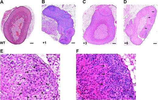 Sf-1 Overexpression Causes Adrenocortical Nodule and Tumor Formation in Mice A, Normal adrenal from a WT mouse; B–D, adrenocortical hyperplasia in Sf-1 TR mice from different TR lines (7, 14, 37 ), with the number of TR Sf-1 copies indicated for each sample; E and F dysplastic lesions in the adrenal cortex of a 10-d-old Sf-1 TR mouse harboring four TR Sf-1 copies. In D–F, arrows indicate areas occupied by dysplastic, abnormally organized cell clusters lying in the subcapsular adrenal region. Magnification, ×10 magnification (A–D; bar, 200 μm) and ×40 (E and F; bar, 20 μm).