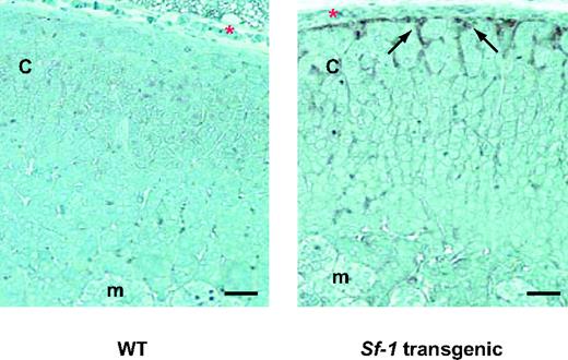 Activated Stat3 Expression in Sf-1 TR Mice Adrenals Y705-phosphorylated Stat3 immunoreactivity (black arrows) is present in a thin rim of subcapsular adrenocortical cells in a 21-d-old animal from line 56 (right panel), whereas it is absent in a WT littermate (left panel). c, Adrenal cortex; m, adrenal medulla. Red asterisk, adrenal capsule. Arrows indicate Y705-phosphorylated Stat3-positive cells. Magnification, ×25; bar, 50 μm.
