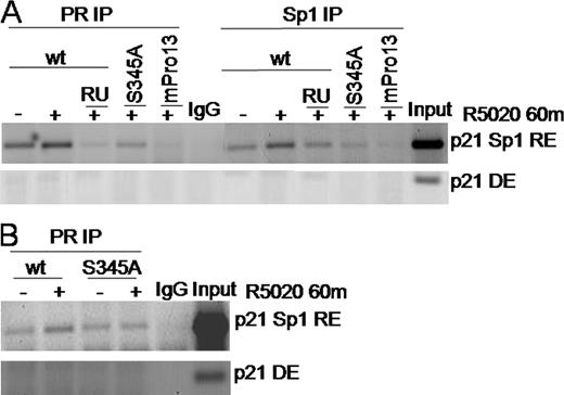 Wild-Type But Not Phospho-Mutant S345A PR-B Is Recruited to the p21 Promoter A, T47D cells stably expressing wt, S345A, or mPro PR-B were treated for 60 min with vehicle, R5020, or R5020 and RU486 before ChIP with Ab for PR, Sp1, or rabbit IgG for a specificity control. PCR were carried out using primers spanning the p21 promoter proximal GC-rich Sp1 response element (RE) or a control distal element (DE) and visualized by ethidium bromide staining of agarose gels. B, HeLa cells transiently transfected with either wt or S345A PR-B were treated for 60 min with vehicle or R5020 and subjected to ChIP with PR Ab or rabbit IgG. PCR using primers specific for the p21 promoter Sp1 (RE) or (DE) were visualized as in A. Results were repeated at least three times with similar results.
