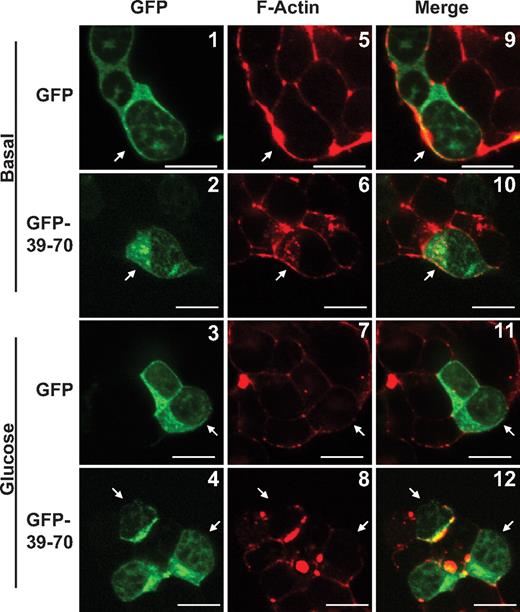 GFP-39–70 does not disrupt normal glucose-induced actin remodeling. MIN6 cells were plated on glass coverslips and transfected to express GFP or GFP-39–70 proteins (green) were preincubated in MKRBB for 2 h and left unstimulated (top panels 1 and 2, 5 and 6, and 9 and 10) or stimulated with 20 mm glucose for 5 min (bottom panels 3 and 4, 7 and 8, and 11 and 12). Cells were fixed, permeabilized, and cortical F-actin staining detected by rhodamine-phalloidin staining (red). Cells in clusters containing both nontransfected and GFP-transfected cells were imaged at the midplane of the cluster by single channel scanning confocal microscopy to determine subcellular distribution of the GFP proteins (panels 1–4) and F-actin remodeling (panels 5–8). Merged GFP and F-actin images are shown in panels 9–12 to permit comparisons between nontransfected and transfected cells. Scale bar, 10 μm. Data shown are representative of three independent sets of experiments.