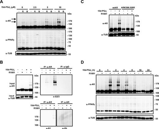 15d-PGJ2 induces formation of endogenous AR-SUMO-2/-3 conjugates in VCaP prostate cancer cells. A, VCaP cells were grown in the presence and absence of R1881 (R; 10 nm) or bicalutamide (B; 10 μm) for 2 h, and 15d-PGJ2 was added at the indicated final concentrations. After 1 h, cells were lysed in a denaturing buffer and the lysates were analyzed by immunoblotting with anti-AR, anti-PPARγ, and anti-α-tubulin (α-TUB) antibodies. The arrows depict the positions of AR-SUMO conjugates. B, VCaP cells were treated with or without R (10 nm) and 15d-PGJ2 (10 μm) as described above. AR was immunoprecipitated with anti-AR antibody, and the precipitates were analyzed by immunoblotting with anti-SUMO-1, anti-SUMO-2/3, and antiubiquitin antibodies. C, PC-3 prostate cancer cells stably expressing wild-type AR (wtAR) or SUMOylation-deficient receptor (ARK386,520R) were exposed to R1881 (R; 10 nm) for 2 h, and 15d-PGJ2 (10 μm final) was added for 1 h as indicated. Lysates were analyzed by immunoblotting with anti-AR and anti-TUB antibodies. D, VCaP cells were treated with 15d-PGJ2 (10 μm) in the presence or absence of androgen (R1881, 10 nm) for the indicated time periods, and immunoblotted with indicated antibodies.