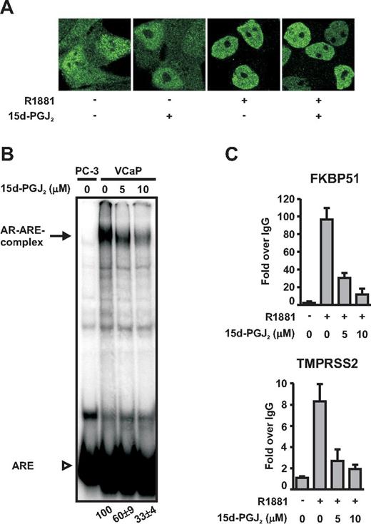 15d-PGJ2 inhibits binding of AR onto chromatin without altering subcellular distribution of the receptor. A, VCaP cells grown on glass coverslips were treated with or without R1881 (10 nm) and 15d-PGJ2 (5 μm for 1 h) as indicated and immunostained with anti-AR antibody and fluorescein isothiocyanate-labeled secondary antibody. Confocal images were collected by a Zeiss LSM 700 microscope. B, EMSAs were performed as described in Materials and Methods with extracts prepared from VCaP cells grown in the presence of R1881 (10 nm) and the indicated concentrations of 15d-PGJ2 for 1 h. An extract from AR-negative PC-3 prostate cancer cells was used as the negative control. The arrow depicts the position of AR-ARE complexes and the arrowhead depicts free ARE. Numbers below the lanes indicate the intensity of AR-ARE complexes in relation to the situation in the absence of 15d-PGJ2 (= 100). Quantification represents the mean ± sd of three experiments. C, For ChIP, VCaP cells were treated with R1881 (10 nm) and the indicated concentrations of 15d-PGJ2 for 1 h, and the samples were processed as described in Materials and Methods. Binding of AR onto FKBP51 and TMPRSS2 regulatory regions was monitored by using real-time quantitative PCR. ChIP assays with normal IgG monitored nonspecific binding. Results are shown as fold increases over the normal IgG-precipitated samples and represent the mean ± sd of three experiments.