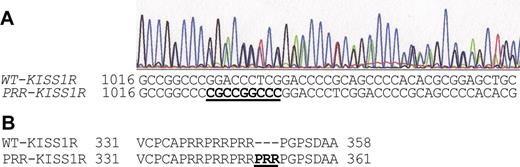 KISS1R heterozygous mutation found in an IHH patient. DNA was extracted from blood lymphocytes. The KISS1R exons were sequenced as explained in Materials and Methods. A, Chromatograms showing double peaks after nucleotide 1023. Inserted nucleotides are indicated in bold and underlined. B, Protein sequence of KISS1R showing the 3 PRR repeats and the additional PRR in bold.