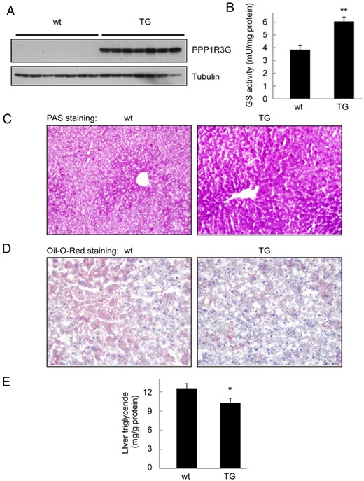 PPP1R3G overexpression increases hepatic glycogen content and GS activity while reduces hepatic triglyceride in the fed state. (A) Expression of PPP1R3G protein in the liver of 4-month-old male wild-type and transgenic mouse in the fed state. These animals were used in measurement of liver GS activity (B, n = 6 for each group), histological analysis using periodic acid Schiff (PAS) staining for glycogen (C), Oil-Red-O staining for triglyceride accumulation (D), and measurement of triglyceride level in the liver (E, n = 8 for each group). The data are shown as mean ± SEM. *, P < .05; **, P < .01.