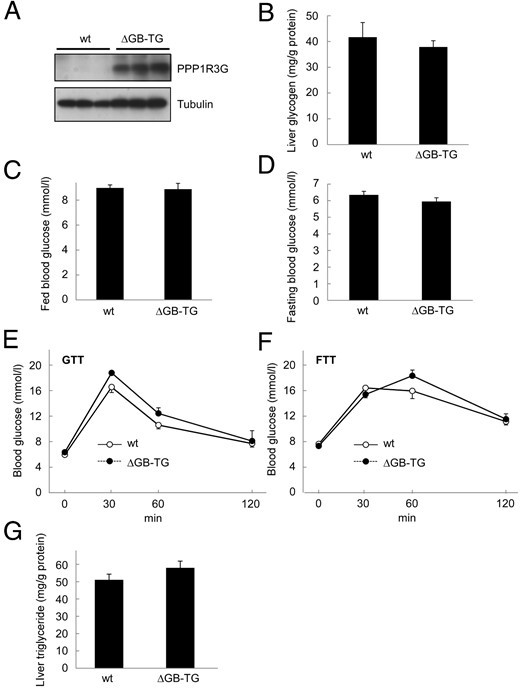 The glycogen binding domain is required for the physiological activities of PPP1R3G. (A) Analysis of PPP1R3G protein in the liver of 9-month-old male wild-type and the transgenic mice that expressed PPP1R3G containing deletion of glycogen binding domain (ΔGB) in the fed state. (B) Measurement of hepatic glycogen content (n = 5 for wild-type and n = 8 for the transgenic mice, respectively, the same for the following experiments). Blood glucose level was analyzed in the fed state (C) and in the overnight-fasted state (D). Glucose tolerance test (E) and food tolerance test (F) were performed in wild-type and the ΔGB transgenic mice. Hepatic triglyceride was measured in the fed state (G). Data are shown as mean ± SEM.