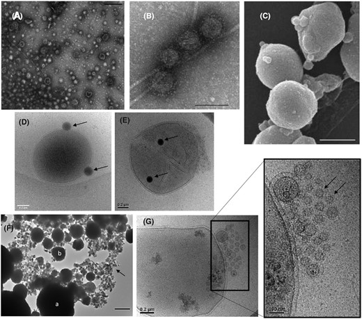 Extracellular vesicles produced by Thermococcales. Transmission electron microscopy images of purified EVs produced by (A)T. nautili showing the size diversity (scale bar, 200 nm) and (B) by T. gammatolerans (scale bar, 100 nm). (C) Scanning electron micrograph of T. kodakarensis cells producing EVs (scale bar, 500 nm). Cryo-electron micrographs of (D)Thermococcus sp. 15-2 and (E)T. prieurii cells associated with dark vesicles named sulfur vesicles (SVs). The arrows indicate SVs. (F) Transmission electron microscopy image of T. kodakarensis cells (a) and EVs (b) entirely mineralized within FeS2 pyrite. The EVs are dispersed among Fe3S4 greigite nanocrystals (indicated by arrow). Scale bar, 500 nm. (G) Cryo-electron micrographs of a T. prieurii cell producing very small EVs (indicated by an arrow) grouped into a spherical structure at the cell surface.