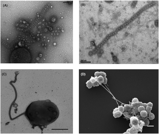 Nanotubes produced by Thermococcales.(A–C)Transmission electron microscopy images: (A)T. prieurii cell producing both EVs and nanotubes containing EVs (scale bar, 200 nm); discrete EVs are surrounded by the cellular S-layer forming the nanotube structure. (B) Long nanotubes containing EVs produced by T. prieurii (scale bar, 200 nm). (C) A cell of Thermococcus sp. 15-2 producing a long nanotube. (D) Scanning electron microscopy image of long nanotubes connecting clusters of Thermococcus sp. 15-2 cells. EVs can be also observed at the surface of most cells (scale bar, 1 µm) (Marguet and Forterre, unpublished observations).