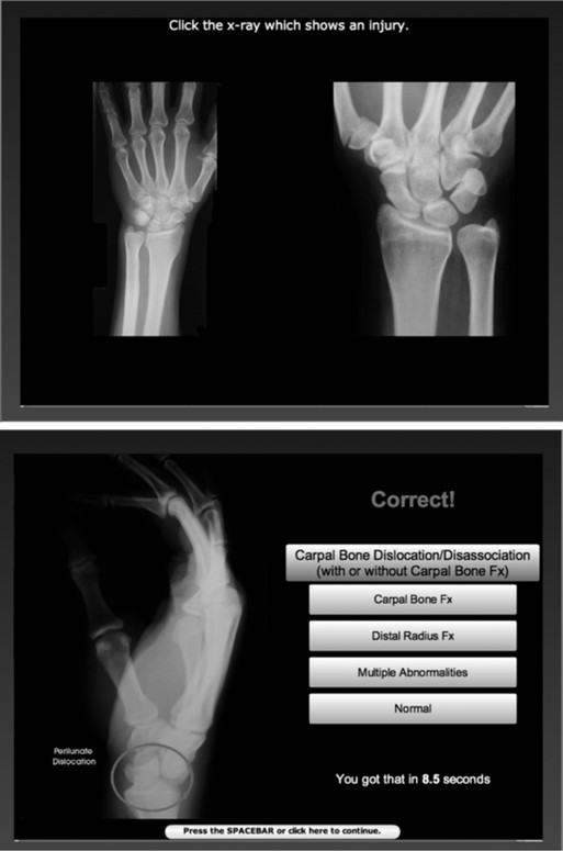 Examples of Some Trial Types in the Wrist X-ray PLM.