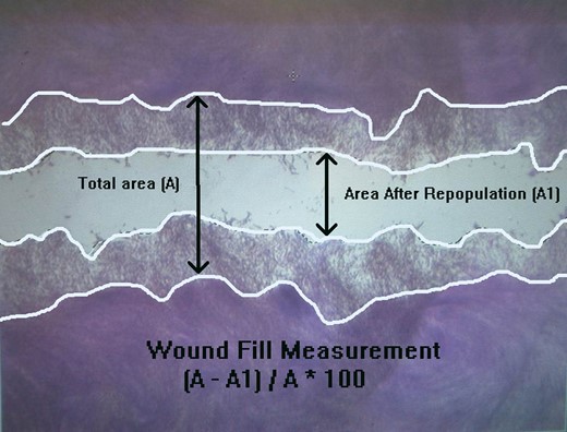 The total wounded area (A) and the area after wound repopulated (A1) of HGFs.