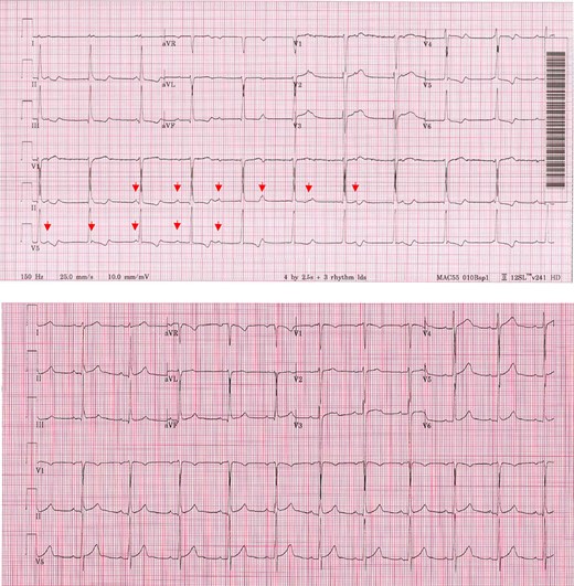Electrocardiograms.