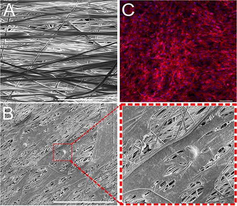 (A) Scanning electron microscopy image of the polyvinylidene fluoride–triflouroethylene (PVDF-TrFE) scaffold consisting of 20% copolymer solution electrospun for 3 hours. Image taken at 1,000× magnification (scale bar = 20 μm). (B) Scanning electron microscopy image of fibroblast cells cultured on electrospun, PVDF-TrFE scaffold. Image taken at 1,000× magnification (scale bar = 100 μm). (C) Fibroblasts integrate with PVDF-TrFE to orient themselves in the direction of nanofiber alignment (scale bar = 100 μm). Cell nuclei stained with 4ʹ,6ʹ-diamidino-2-phenylindole dihydrochloride (blue) and cytoskeleton stained with rhodamine phalloidin (red).