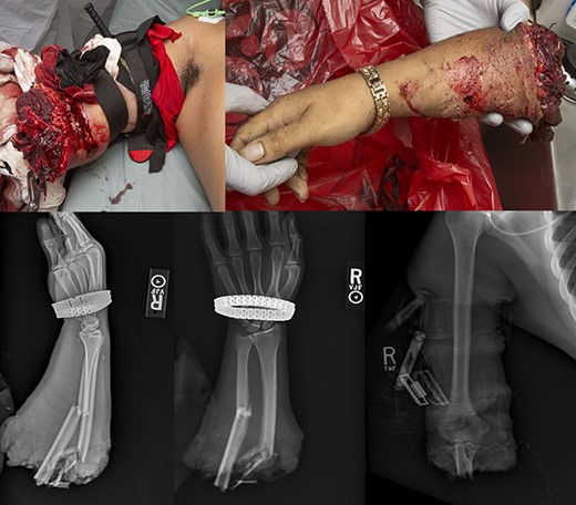 Preoperative injury photographs and radiographs.