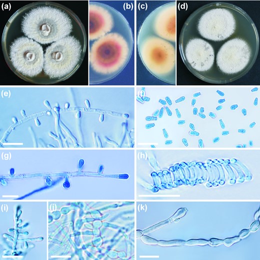Trichophyton onychocola CCF 4259T colonies after three weeks of cultivation at 25°C on SGA (a) and reverse (b); on MEA (c) and reverse (d); microconidia on short pedicels or sessile (e, g) on the hyphae (conidiophore); clavate microconidia (f); spiral hypha (h); slightly branched conidiophore (i); chlamydospore-like cells and swollen hyphae (j,k). Scale bars, 10 μm. This Figure is reproduced in color in the online version of Medical Mycology.