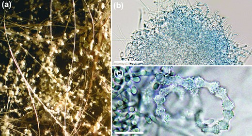 Gymnothecium-like structures present on OA with sterilized human hairs and observed under stereo microscope (a) and light microscope (b); scale bar, 50 μm. Peridial hyphae consisting of ossiform peridial cells (c); scale bar, 10 μm. This Figure is reproduced in color in the online version of Medical Mycology.