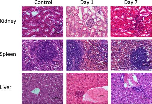 Representative histopathological hematoxylin-eosin stained sections of kidneys, spleens and livers from BALB/c mice intravenously infected with 1 × 106 of cfu/mice of the strains tested by day 1 and 7 post-challenge. Scale bar equals 50 μm. This Figure is reproduced in color in the online version of Medical Mycology.