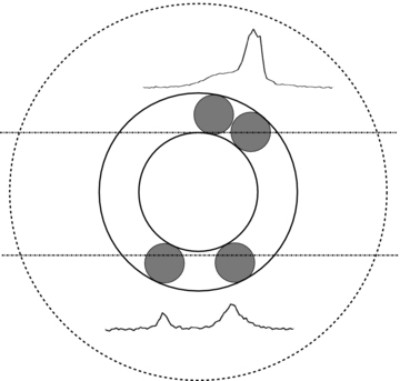 A possible configuration for the beam of PSR B0906−49. The active regions in the magnetosphere appear to fall into the same cone for both MP and IP and so we have shown only one cone here. The outer dotted circle represents the region bounded by the last open field lines. The active emission cone is shown by the solid circles; its location and width is dictated by the width of the pulse profiles. The line of sight for the MP traverse is the top solid line; it cuts two active patches near the centre and on the trailing edge of the cone. The line of sight for the IP traverse (bottom solid line) also cuts through two active patches but they are more symmetrically placed about the beam centre. The resultant pulse profiles (MP and IP) are also shown.