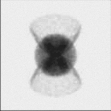 A shape spatio-kinematic model of ETHOS 1.