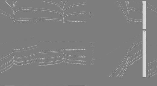 Eigenfrequencies σ (upper panels) and damping times τb+s (lower panels) versus T∞ for quadrupole (l = 2) oscillation modes in an increasingly larger scale. The normal p1 mode is shown by solid lines. Lower left-hand panel coincides with Fig. 8(e). Other lower panels are zoomed in versions of Fig. 8(e). Notations are the same as in Figs 6 and 8.