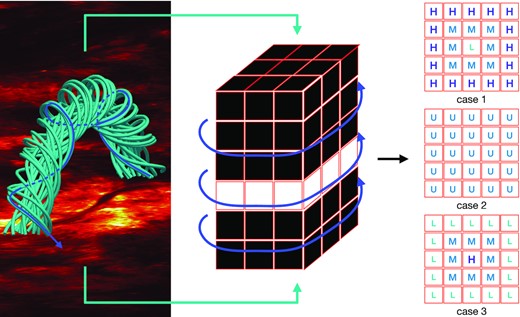 Sketch map of the 3D solar CA model. The left-hand panel shows a magnetic flux rope constructed by using the TDm model. The middle panel shows the latticed flux rope composed of 30 × 30 × 30 nodes. The right-hand panel describes three kinds of driving mechanisms leading to avalanches.