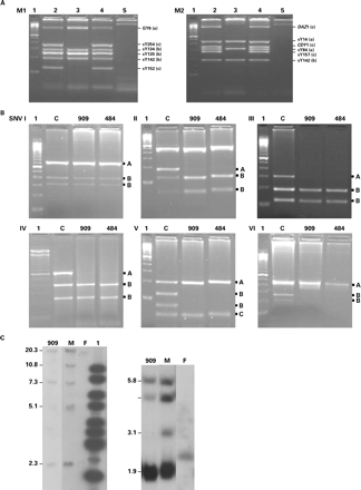 (A) Agarose gel electrophoresis from two different multiplex PCR reactions (M1, M2) showing two patients, with no AZF deletions (lanes 2) and with a large AZFc deletion (lanes 3), and controls (lanes 4: fertile male; lanes 5: female). (B) DAZ single nucleotide variants (SNV) (I–VI) analyses of genomic DNA samples of two patients (909; 484) with incomplete meiotic arrest (MA) and of a fertile male control (C). The A allele was defined as not restricted and the B allele as restricted (two fragments). The C fragment in SNV-V was constant in all samples analysed. Lane 1: 100 bp DNA ladder. (C) DYS1-EcoRV and TaqI DNA Southern blot. In sample 909, the DAZ1 deletion is indicated by absence of the 10.8 kb EcoRV fragment, and the DAZ2 deletion is indicated by absence of the 3.1 kb Taq I fragment. Control fertile male (M) and female (F) DNA.